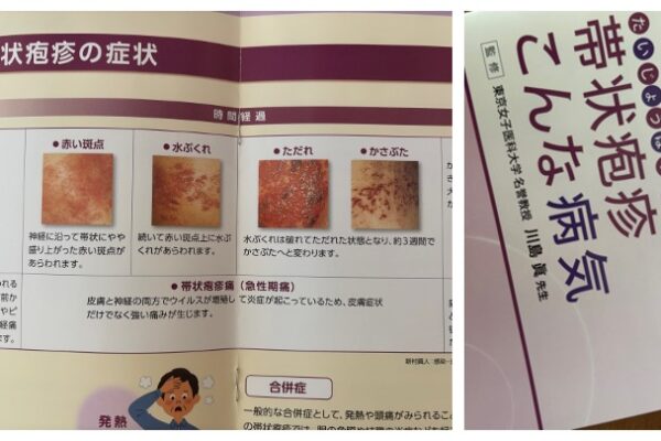 帯状疱疹が教えてくれた、粘り強さの真髄